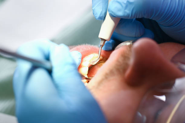 Best Emergency Denture Repair in Ridgecrest, FL